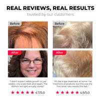 Real customer results with TYMO TRITHERA microcurrent hair brush showing visible growth.