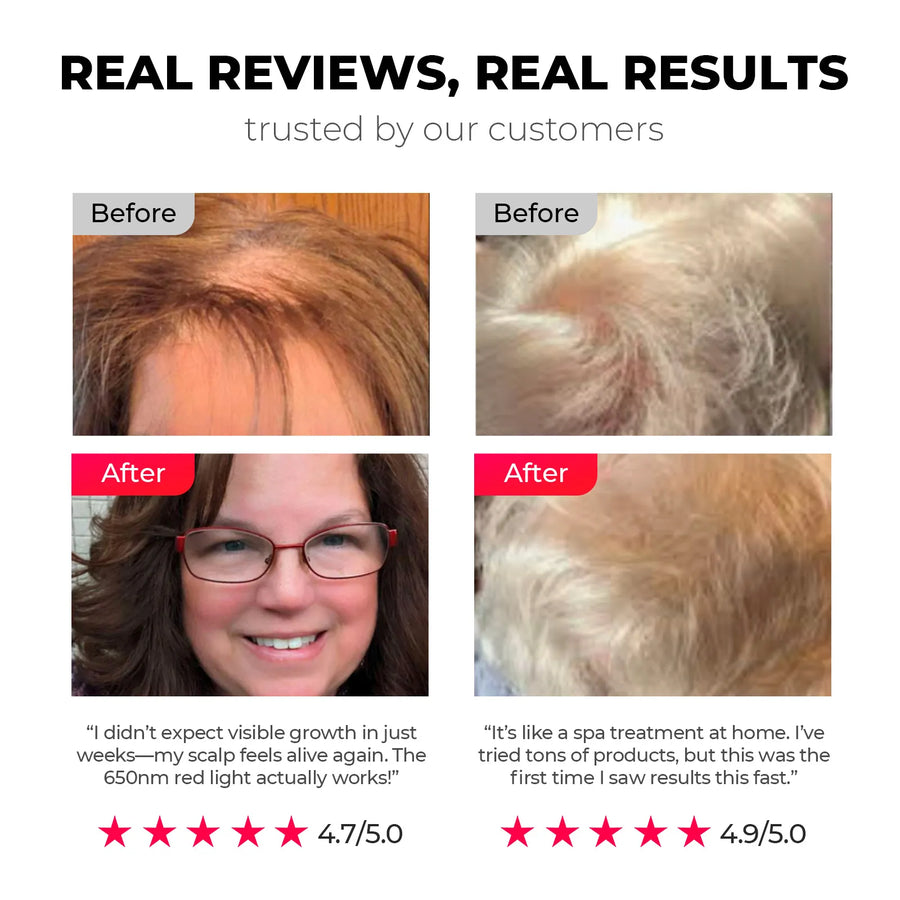 Real customer results with TYMO TRITHERA microcurrent hair brush showing visible growth.